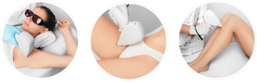Zonas del cuerpo para depilación láser