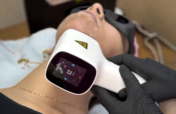 Video testimonial de tecnología de depilación Fénix 4D