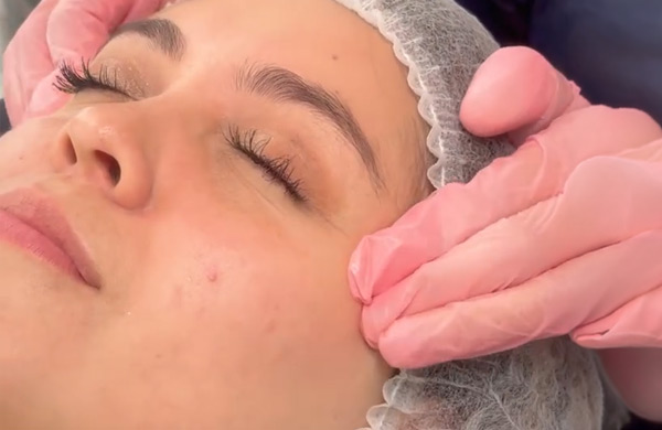 Video testimonial de Cuidado Facial en Blink Care